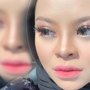 "Nak Saman, Takut Dia Bunuh Diri Pula" - Hidung Dihina, Siti Sarah Patut Saman Atau Tak?