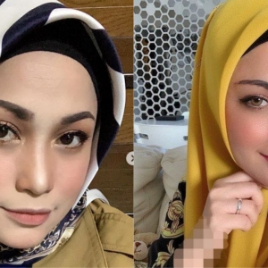 "Bukan Perasan Bagus, Tapi Leher Pun Aurat"- Ezlynn Tolak Job Drama