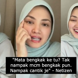 Fazura "Live IG" dengan mata ketumbit, netizen tetap puji cantik siap bagi petua surutkan bengkak