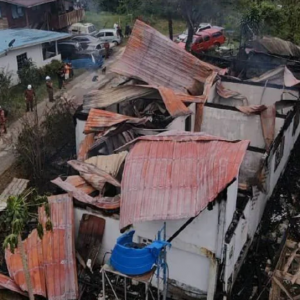 Suami Maut Terbakar, Isteri Melecur Di Muka Dan Badan