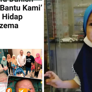 Pernah Tampung Kos Rawatan Ekzema Kritikal, Nedim Teruja Adriana Dah Masuk Sekolah!