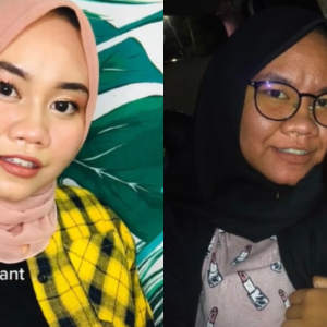 Walau Dihina Berkali-kali, Wanita Muka Berkedut Ketika Hamil Syukur Suami Sentiasa Setia