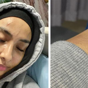 Polis Tengah Buat Lakaran Wajah Suspek Serang Lufya Omar