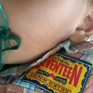 Doktor Tampar Budak 3 Tahun, Enggan Bagi Rawatan Kerana Dicarut