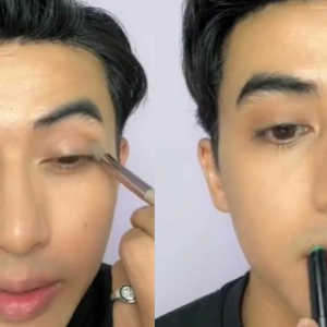 Lainnya Muka, Zoey Rahman Suntik Botox?