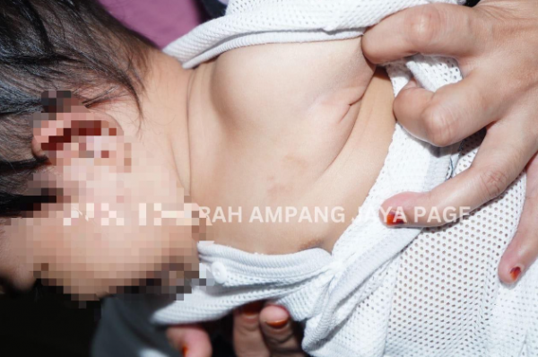 Kesan Gigitan Pada Muka Dan Pulasan Pada Kedua-Dua Telinga Bayi, Pengasuh Ditangkap