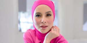 Pigmentasi, Kedut, Mata Mula Nampak Jatuh- Suami Tetap Tak Bagi Daphne Iking Buat Botox