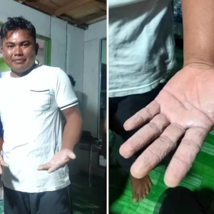 Al Sipal Makan Sotong Hidup Untuk Bertahan Sepanjang 14 Jam Hanyut Ketika Memancing