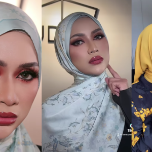 “Jadi Bila Ada Peluang, Apa Salahnya?", Zara Zya Mengaku "Cucuk" Muka Dan Bibir