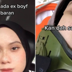 Ex BF Cengkam Perut, Selalu Tampar, Tolak Sampai Jatuh Terduduk, Dah Putus Gadis Menderita Ada Slip Disc Kekal