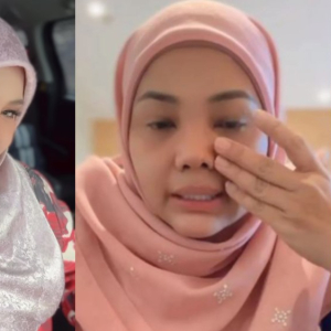 "Saya Adalah Ubah Sikit Hidung Ini..." Zarina Zainuddin Mengaku Ubah Hidung Lepas Bedah Buang Cecair