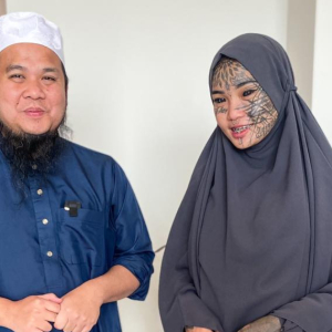 Netizen Dah Tak Sedap Hati Bila Ebit Kata Mondy Buat Tatu Sendiri, Pakai Braces RM15