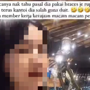 Syok Borak Pasal Braces, Terpecah Rahsia 'Kawtim' Dengan Doktor Guna Dana Kerajaan