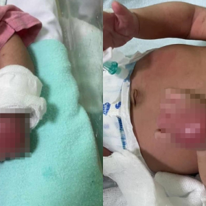 Bayi Dibedah Buang Nanah, Bapa Saudara Dakwa Hospital Punya Kerja Tangan Membengkak