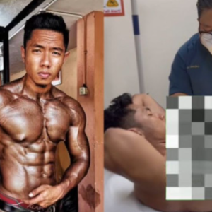 Ambil PED Nak Badan Cantik-Abang Sado Menyesal Seumur Hidup, Puting Jadi Pelik Terjojol, Disahkan Hidap Gyno