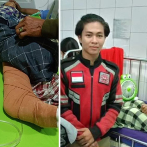 Budak 11 Tahun Masih Senyum Walau Kaki Kudung Digilis Lori Simen Gara-Gara Selamatkan Kucing