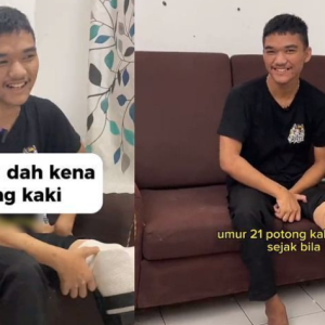 "Balik Sekolah Je Beli," Ketagih Air Berkarbonat, Kaki Lelaki Usia 21 Tahun Dah Kena Potong