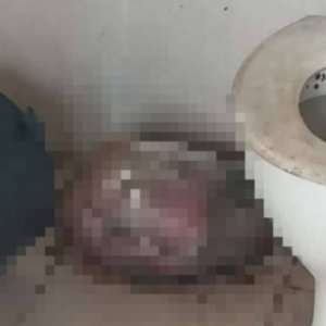 Patutlah Bau Busuk, Mayat Bayi Perempuan Dibuang Di Tandas Surau Di Besut