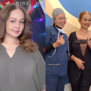 Jasmin Hamid Gembira Berat Badan Turun Hampir 10kg Selepas Sebulan Buat Pembedahan Bariatrik