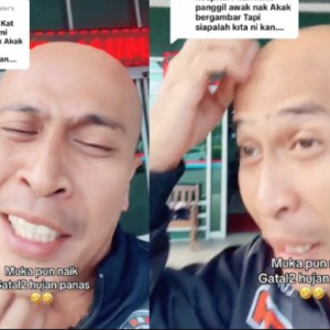 Achey Respon Netizen ‘Merajuk’ Tak Layan Diajak Bergambar – ‘Staff Saya Accident, Bukan Saya Datang Hospital Buat Show’