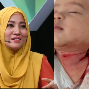 Bayi lelaki Yana Samsudin suka garu leher sampai berdarah - "Anak korang penah jadi macam ini tak?"