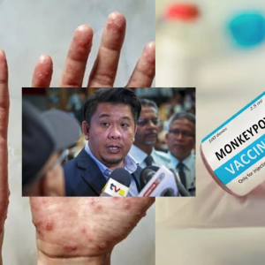 Kerajaan Malaysia Belum Bercadang Laksana Program Vaksinasi Penyakit Monkeypox Untuk Rakyat - Timbalan Menteri Kesihatan