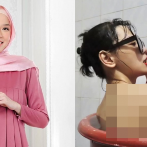 “Korang Tak Rasa Apa Saya Rasa..” – Nonny Nadirah Dedah ‘Tanggal’ Tudung & Berkemban Sebab Disihir