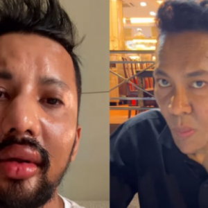 Pukul Razman Razmi, Aqo Imran berdepan hukuman penjara 10 tahun